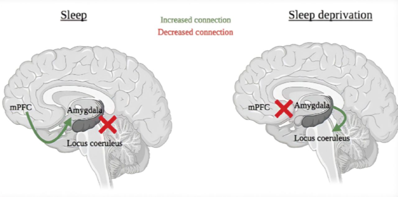 the-consequences-of-sleep-deprivation-on-cognitive-performance